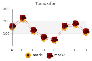 generic 20 mg tamoxifen amex