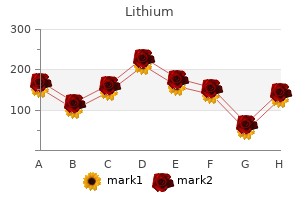 order lithium now